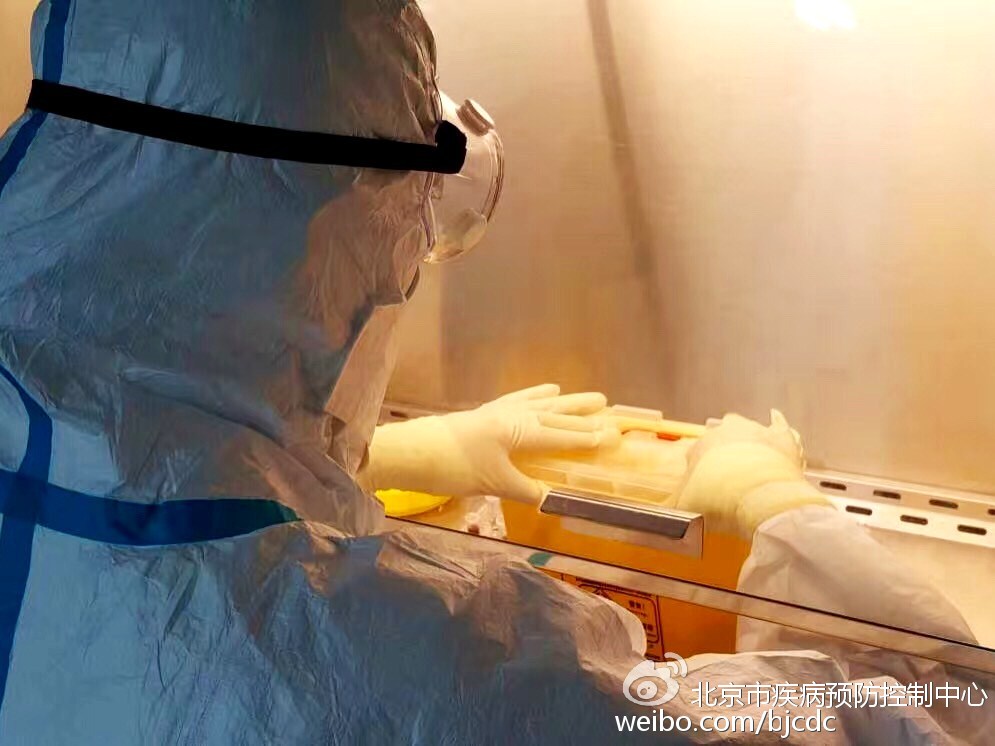 北京市發(fā)現(xiàn)我國首例輸入性裂谷熱病例 北京市發(fā)現(xiàn)我國首例輸入性裂谷熱病例